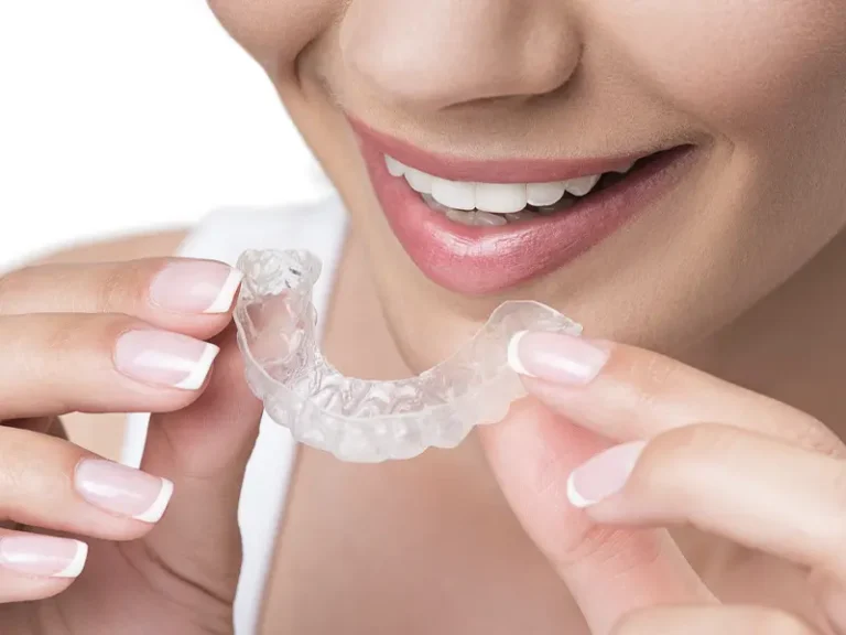 Alinhadores Cisos Odontologia