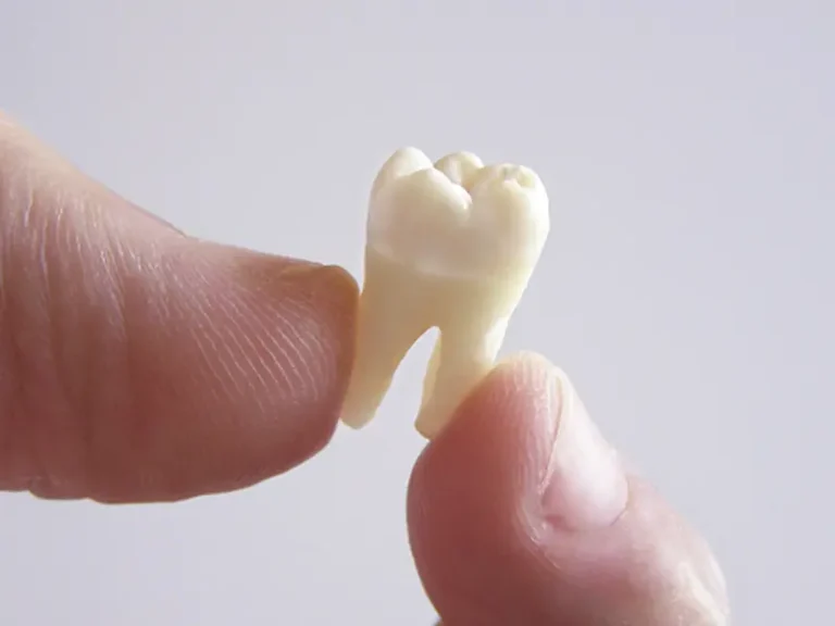 Extrações Cisos Odontologia