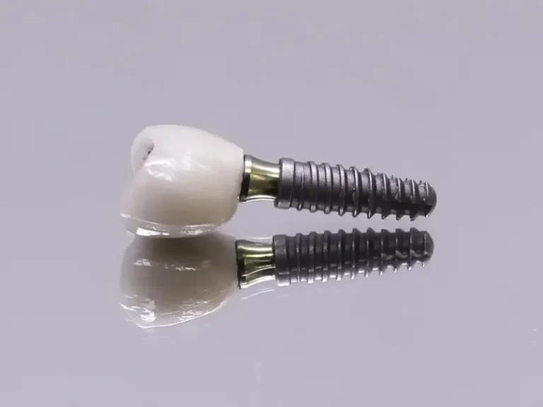 Implantes Cisos Odontologia