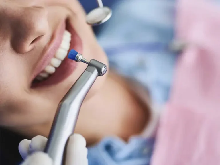 Limpeza Cisos Odontologia