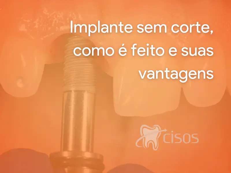 Implante sem corte, como é feito e suas vantagens.