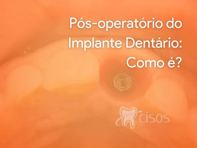 Pós operatório do implante dentário