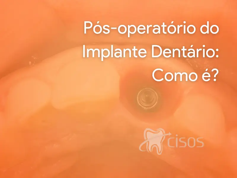 Pós operatório do implante dentário