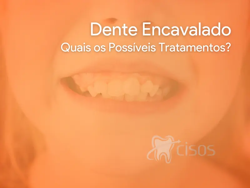 Dente Encavalado - Quais os Possíveis Tratamentos?