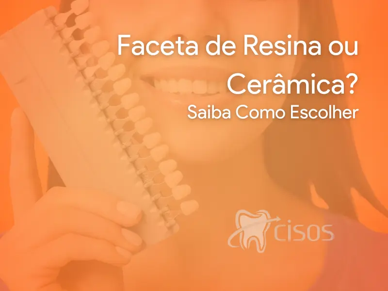 Facetas Dentárias